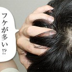 フケが多いのは薄毛の前兆