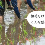 植毛と田植えは似ている