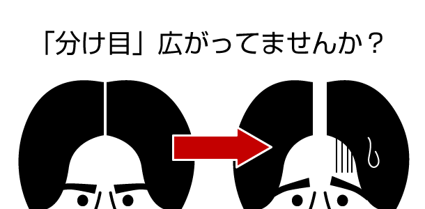 分け目広がっていませんか？