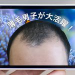 薄毛男子が大活躍