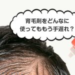 育毛剤をどんなに使ってももう手遅れ？